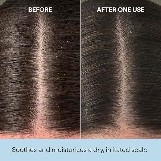 Scalp Care to Textured Hair